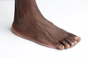 foot-podiatry-generic Close-up of a human foot on a white background, used as a generic image for podiatry care.